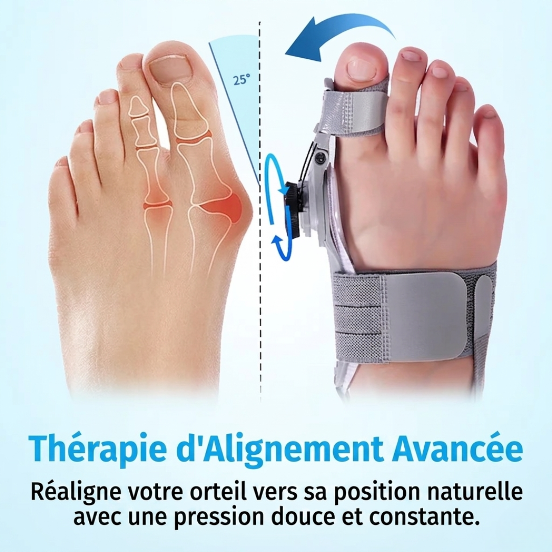 CureMedy™ — Correcteur d'Hallux Valgus